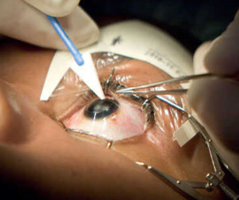 Promotional image for 'In Hindsight' docuseries with medical procedure imagery.